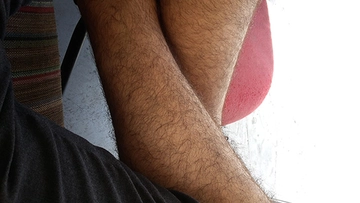 Bacak Kılları Nasıl Alınır?